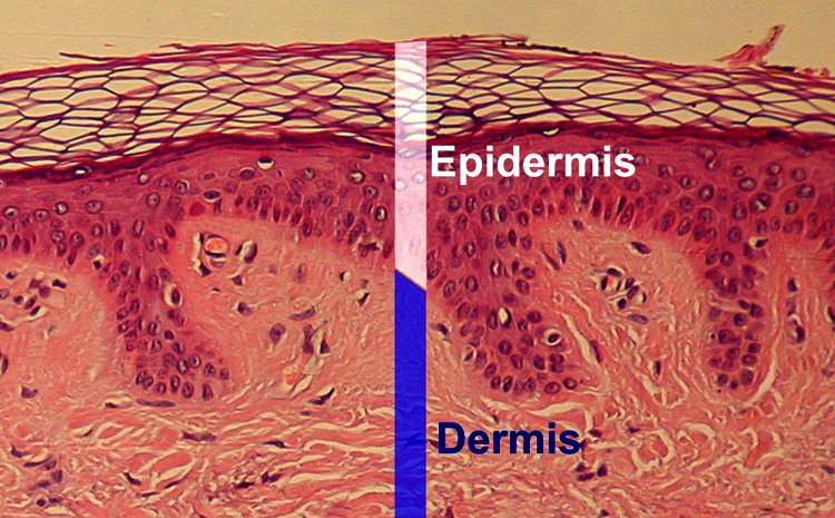 Derma